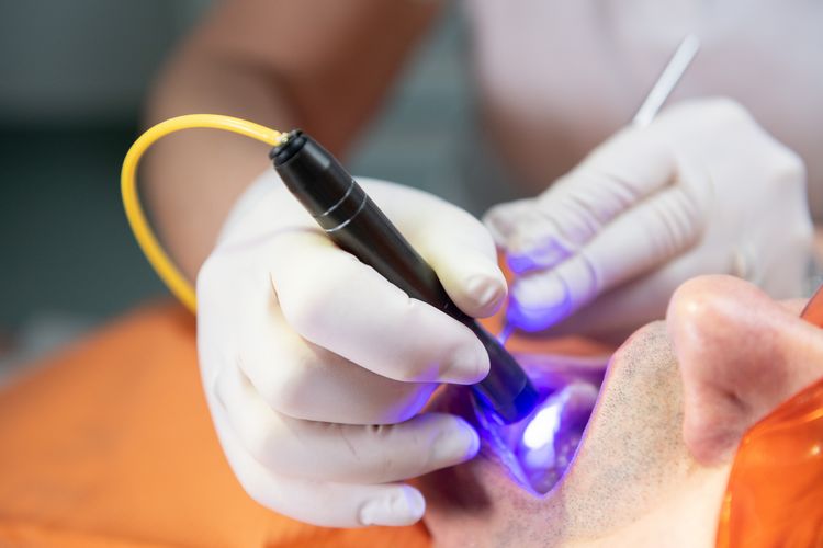 laser dentale perugia magione